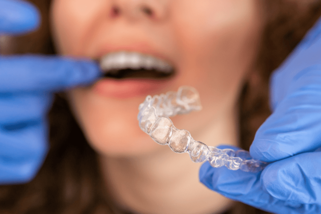 Nasıl En İyi Şeffaf Plak Hastası Olursunuz? invisalign şeffaf plaklar tel kadar etkilimi. Şeffaf plakmı telmi. orthero şeffaf plak. dr. özlem aylıkcı ortodonti uzmanı. ,nvisalign diamon provider